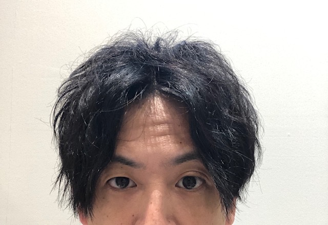 【M字 前髪】パーマかけることで前髪は伸ばすことが出来る？！徹底解説☆ INTI report 薄毛に悩む男性の為の美容院「INTI